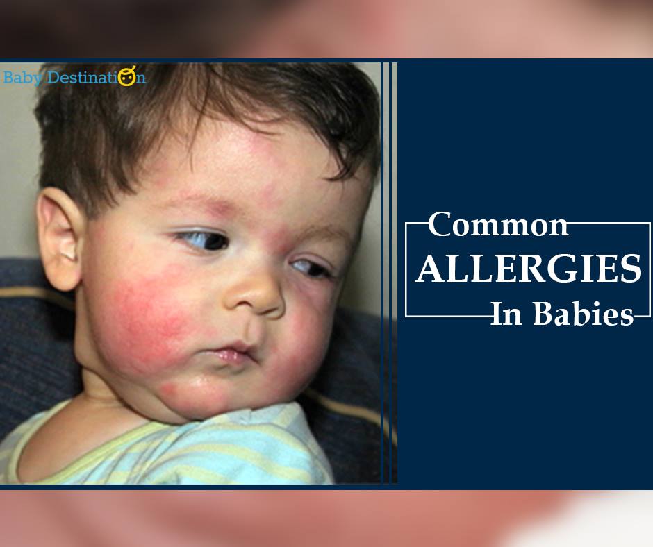Common Allergies In Babies