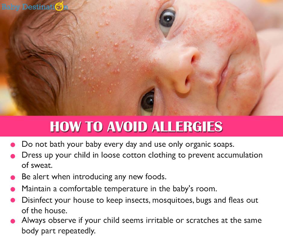 Common Allergies In Babies