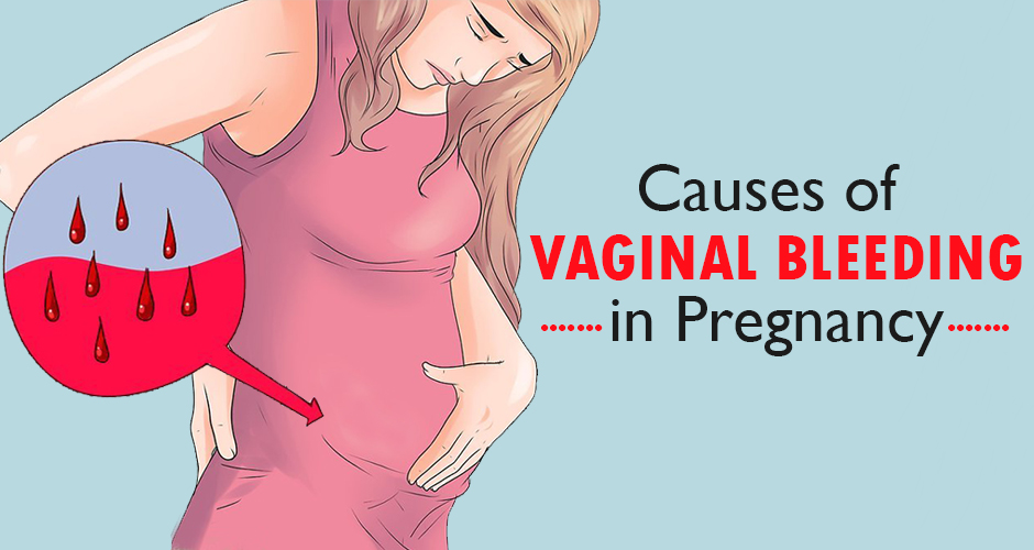 what-causes-a-woman-to-bleed-during-pregnancy-pregnancywalls