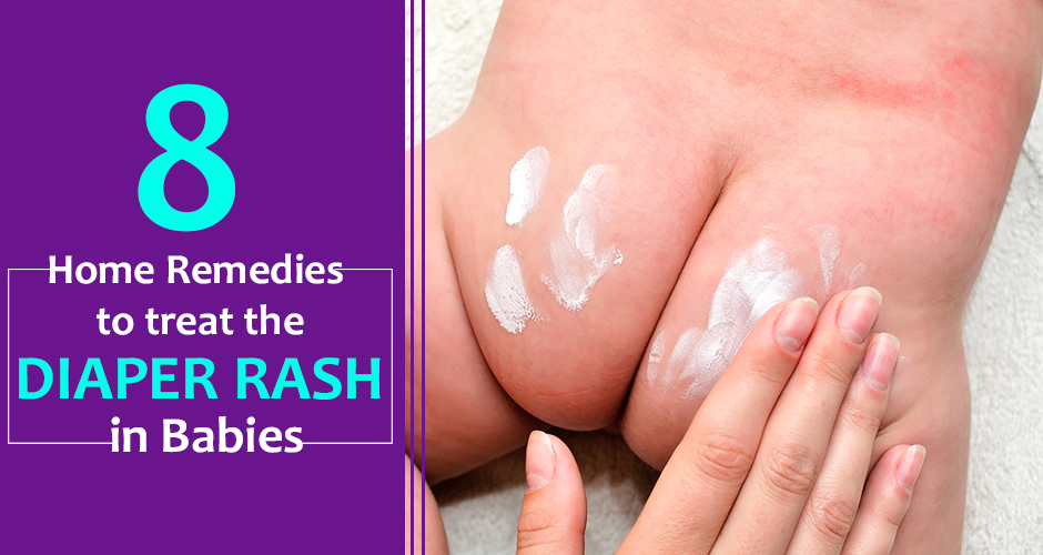 8 Effective Home Remedies To Treat Diaper Rash In Babies