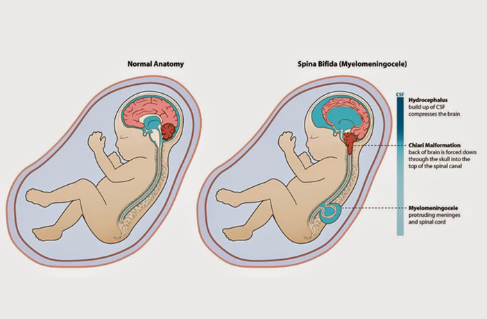 Importance of folic acid during pregnancy