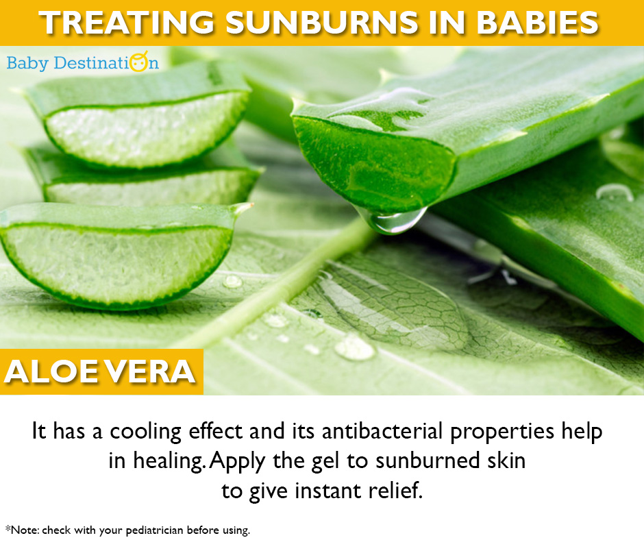 Home Remedies To Cure Sunburn In Babies