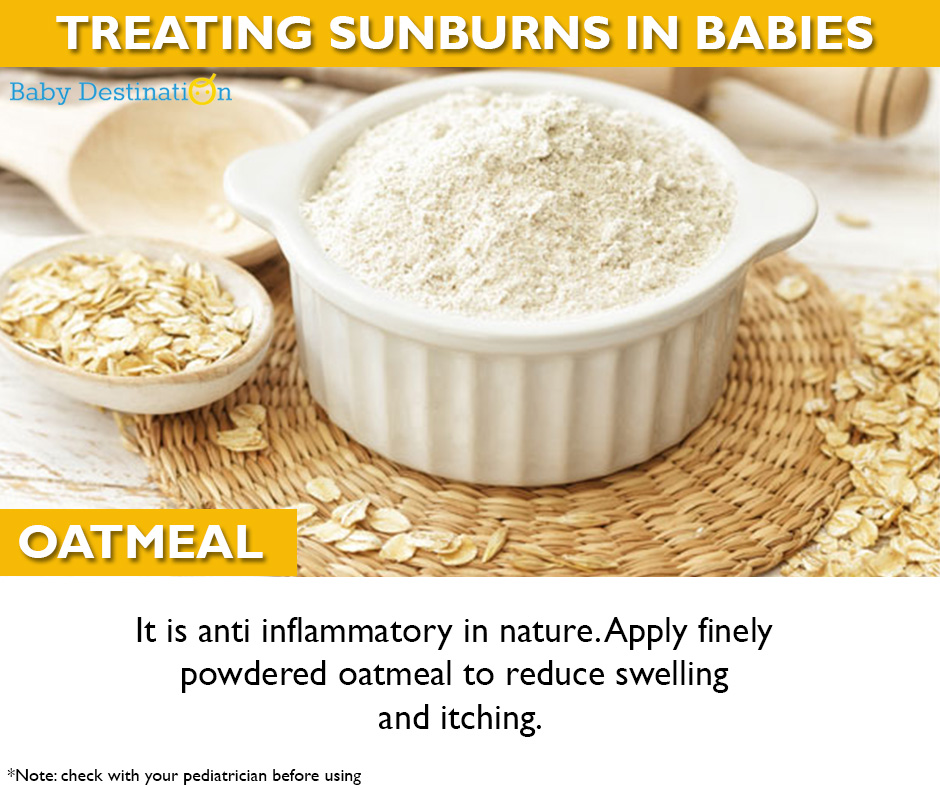 Home Remedies To Cure Sunburn In Babies