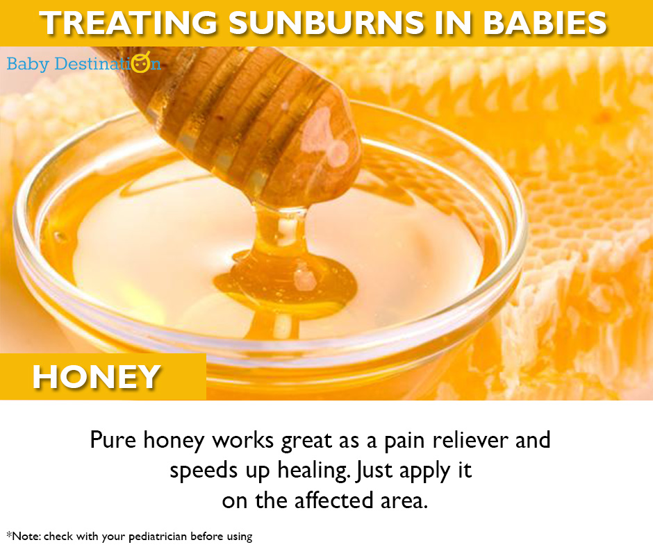 Home Remedies To Cure Sunburn In Babies