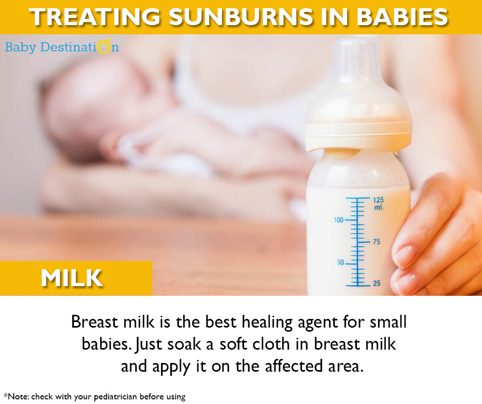 Home Remedies To Cure Sunburn In Babies