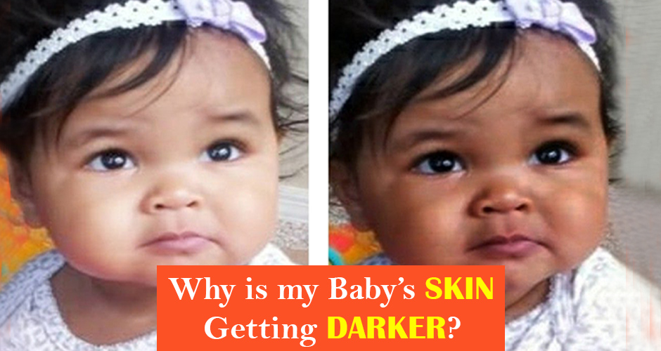 Baby's Skin Color | 10 Effective Tips For Healthy & Whitening Skin