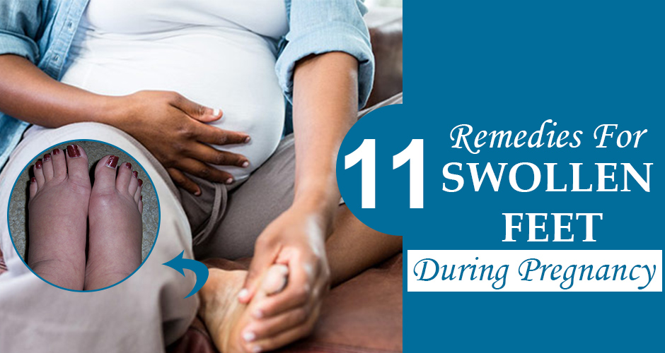 11 Remedies For Swollen Feet During Pregnancy