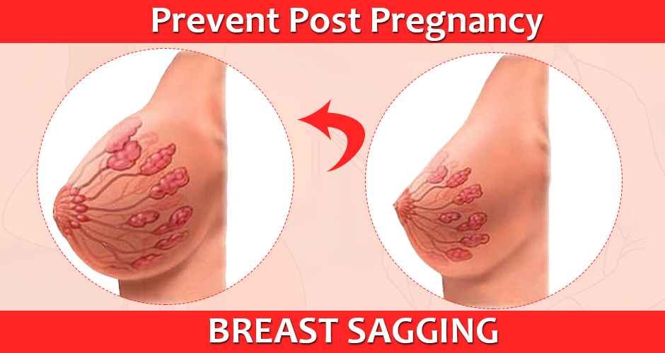 6 Effective Ways to Prevent Post Pregnancy Breast Sagging