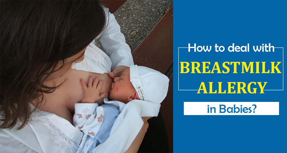 How To Identify And Deal With Breast Milk Allergy In Babies