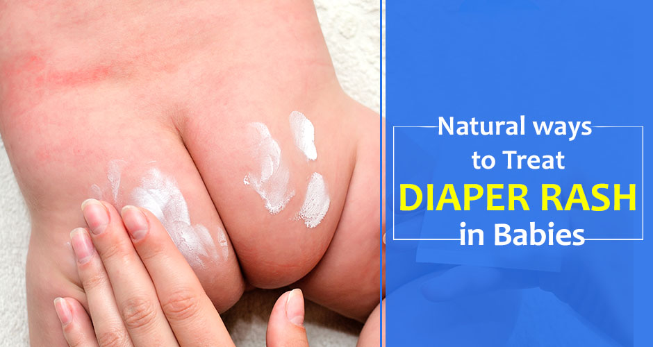 Diaper Rash: Causes & Ways to treat it naturally