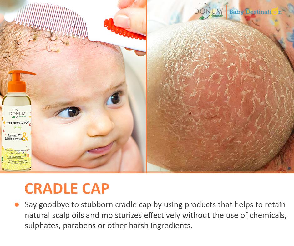 Common Skin Problems in Babies