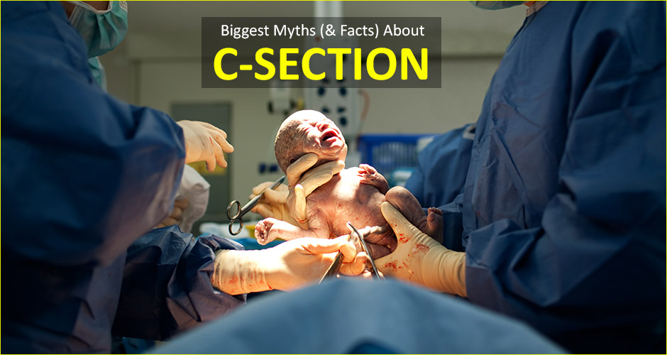 7 Biggest Myths And Facts About C-Section