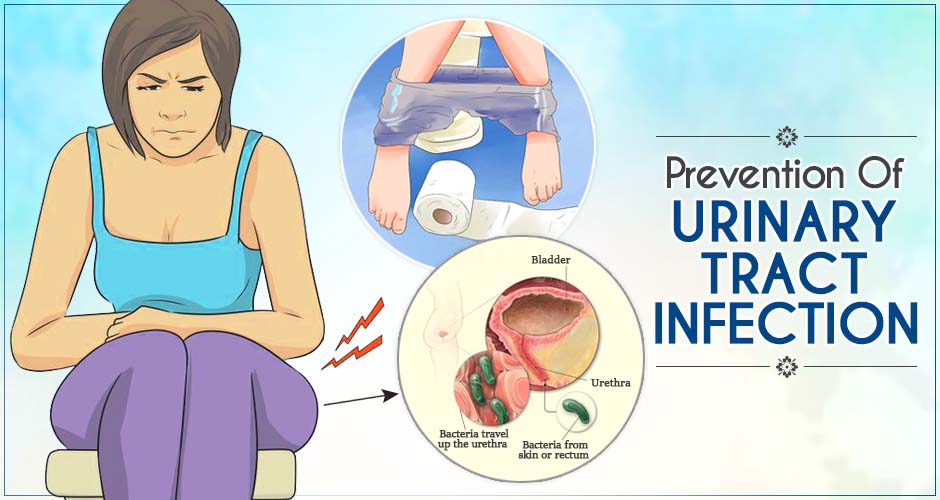 11 Ways To Prevent Urinary Tract Infection