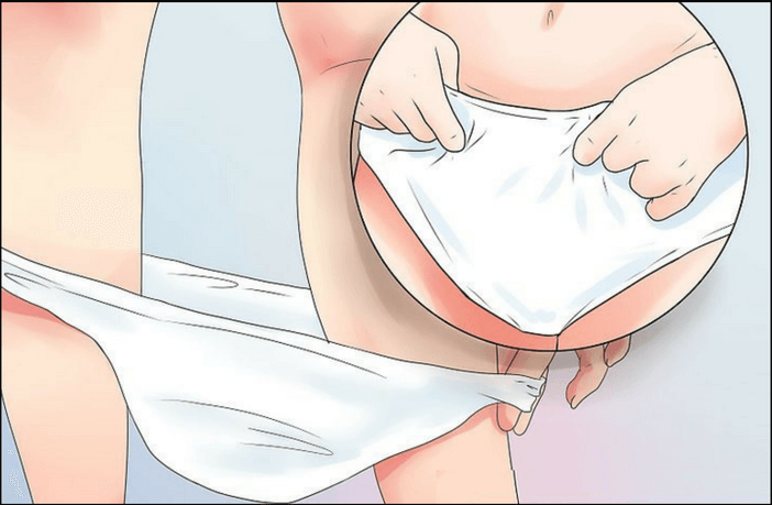 Urinary Tract Infection: Causes & Symptoms