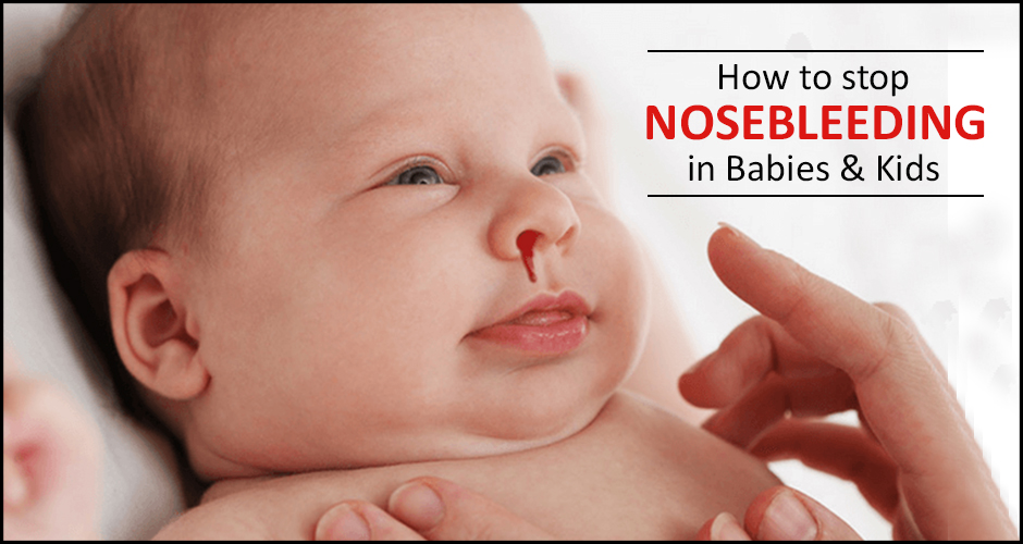 home remedies for nose bleeding in babies