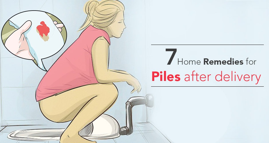 7 Excellent Home Remedies for Piles (Hemorrhoids) After Delivery