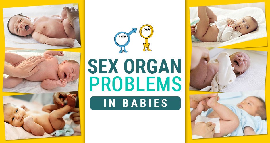 9 common SEX ORGAN problems in babies which you must know