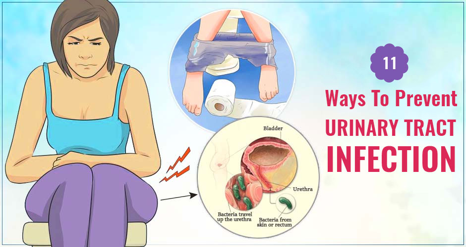 11 Ways To Prevent Urinary Tract Infection