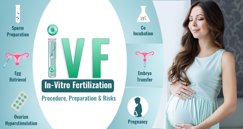 In-Vitro Fertilization (IVF): Procedure, Preparation & Risks