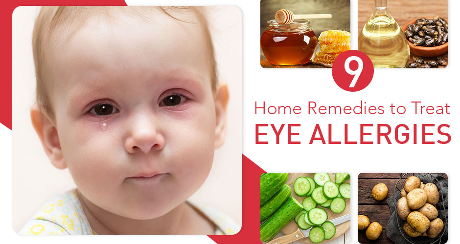 9 Home Remedies For Eye Allergies That Are Simple Yet Effective for kids