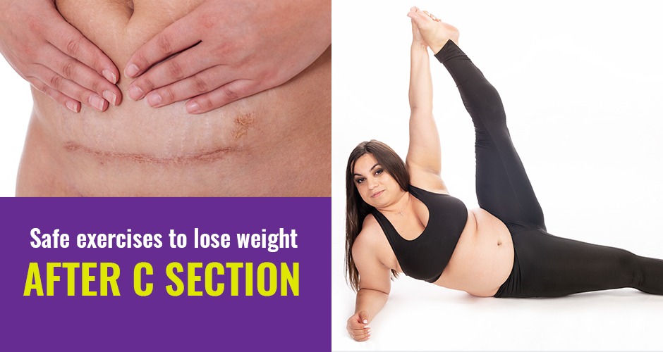 Safe And Simple Exercises To Lose Weight After A C-section