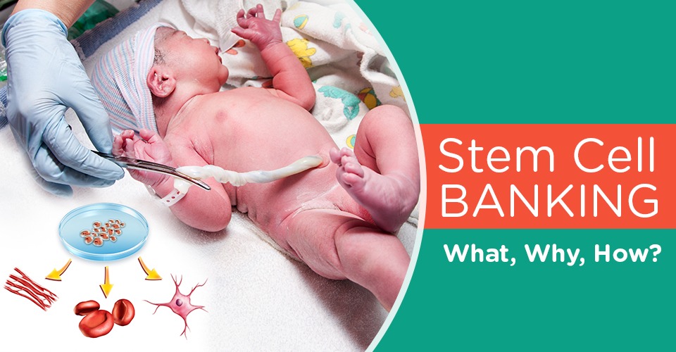 Everything You Need To Know About Stem Cell Banking