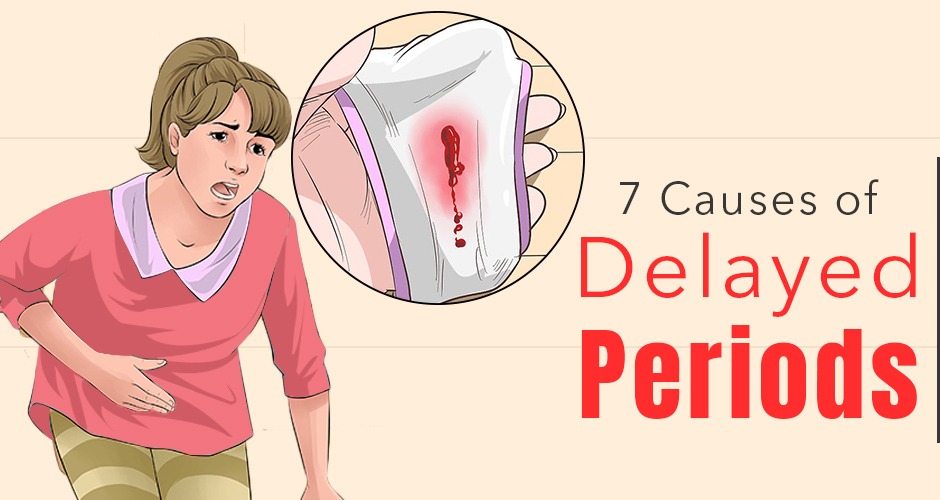 7 Causes Of Delayed Periods And What You Should Do About It