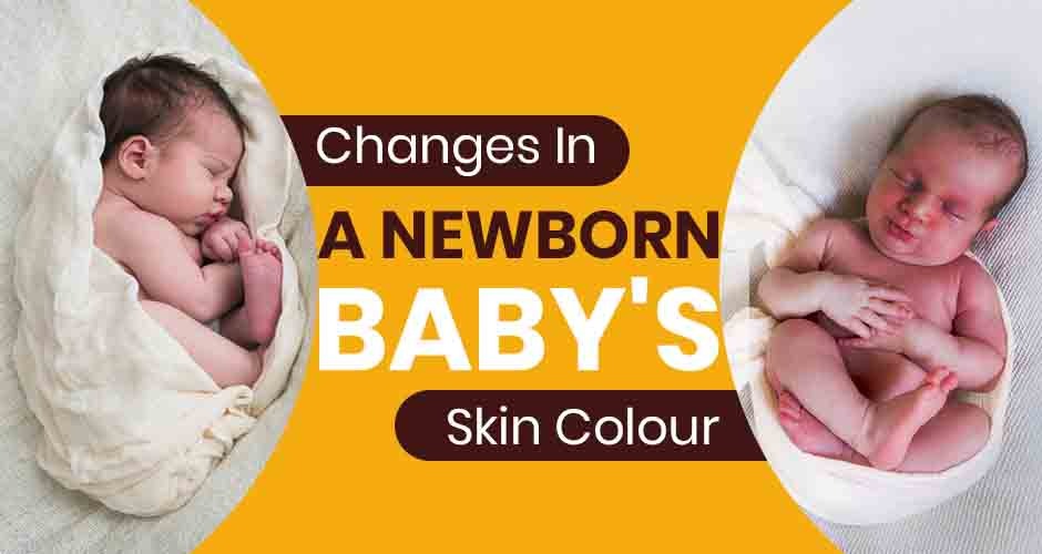7 Reasons Why A Newborn Baby's Skin Colour Changes