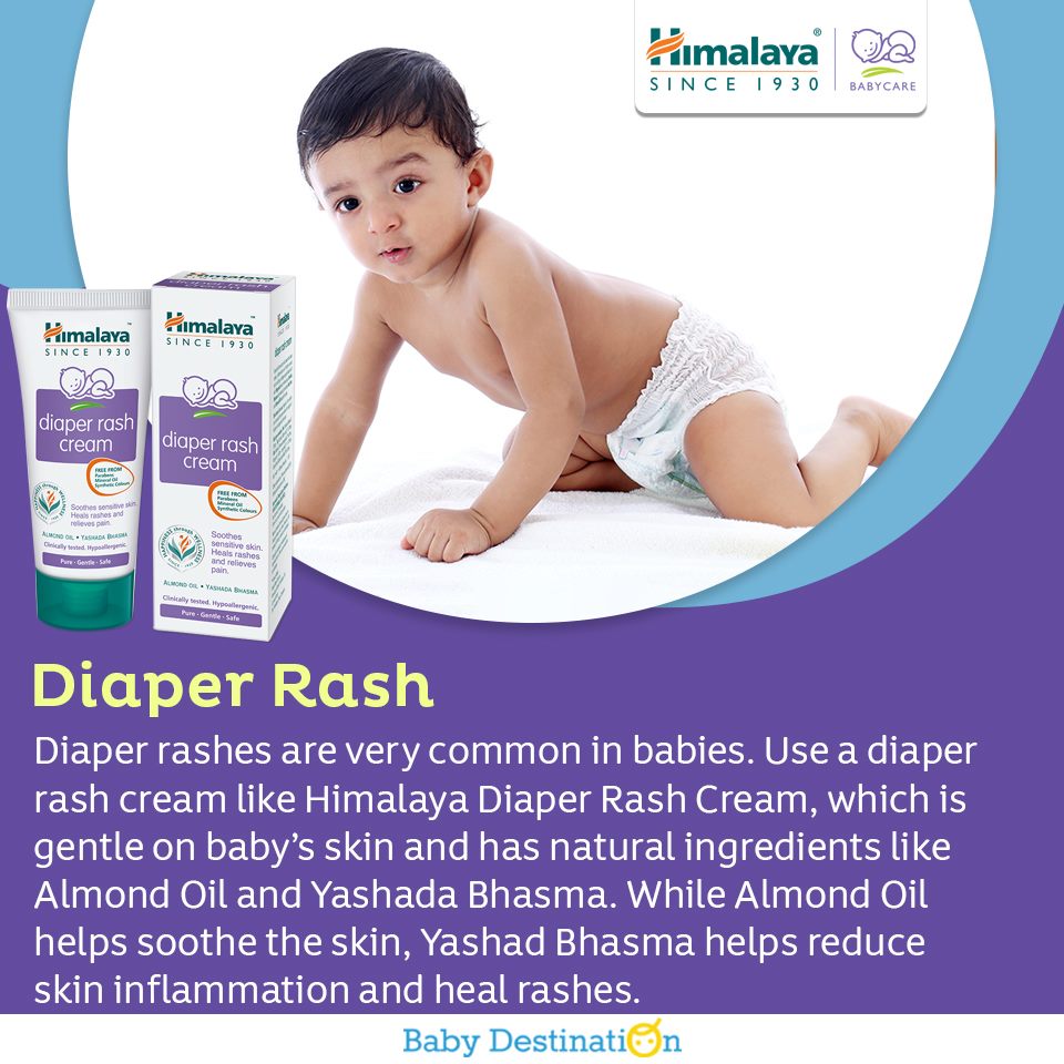 5 Ways To Treat Rashes In Babies During Monsoon