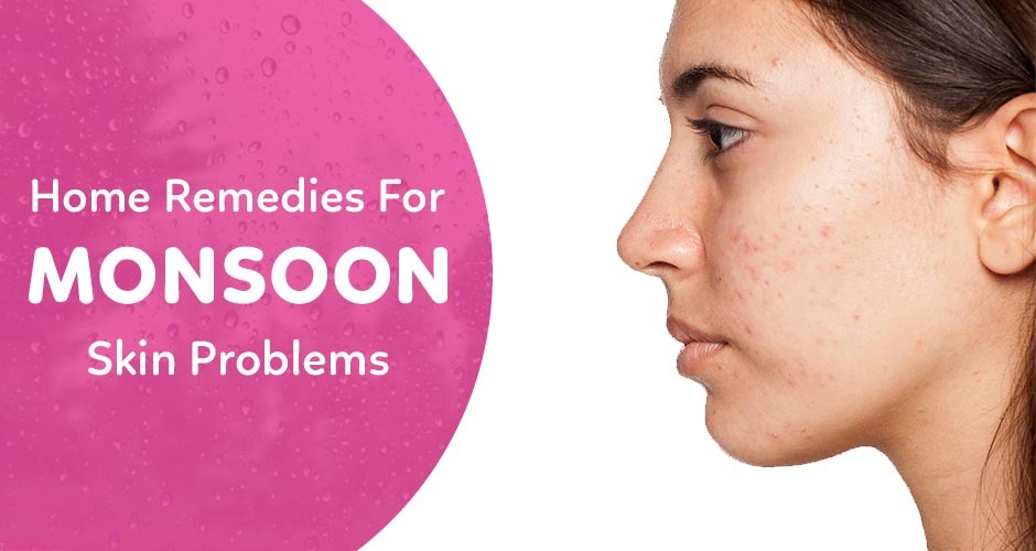 7 Common Monsoon Skin Problems And How To Fix Them?