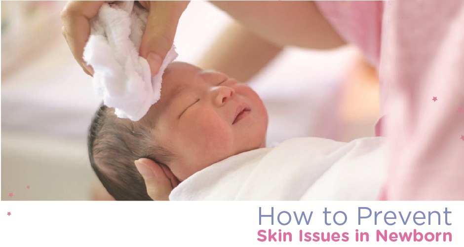 How to Prevent Skin Issues in Newborn